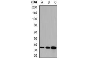 Image no. 1 for anti-Glycerol-3-Phosphate Dehydrogenase 1 (Soluble) (GPD1) (full length) antibody (ABIN6043498)