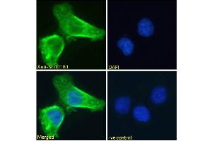 Image no. 3 for anti-Solute Carrier Organic Anion Transporter Family, Member 1B3 (SLCO1B3) (Internal Region) antibody (ABIN570800)