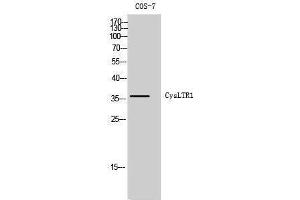 Image no. 1 for anti-Cysteinyl Leukotriene Receptor 1 (CYSLTR1) (Internal Region) antibody (ABIN3184209)