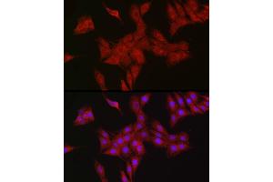 Immunofluorescence analysis of PC-12 cells using RBCK1 antibody (ABIN7269848) at dilution of 1:100.