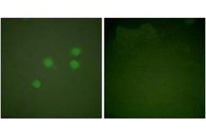 Image no. 3 for anti-Cyclin E1 (CCNE1) (AA 91-140) antibody (ABIN1533249)