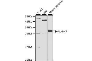 ALKBH7 抗体  (AA 1-221)