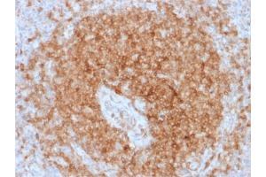 Image no. 4 for anti-B-cell antigen receptor complex-associated protein alpha chain (CD79A) antibody (ABIN6941260)