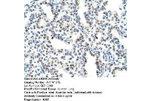 Rabbit Anti-WDR6 Antibody  Paraffin Embedded Tissue: Human Lung Cellular Data: Alveolar cells Antibody Concentration: 4.