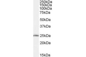Image no. 2 for anti-SAR1 Homolog B (SAR1B) (Internal Region) antibody (ABIN334486)