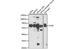 Image no. 1 for anti-Tyrosyl-tRNA Synthetase (Yars) antibody (ABIN6570715)