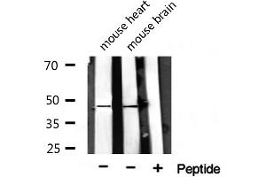 Image no. 2 for anti-Coagulation Factor II (thrombin) Receptor (F2R) antibody (ABIN6265563)