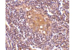 Image no. 2 for anti-CD5 Molecule-Like (CD5L) (C-Term) antibody (ABIN318735)