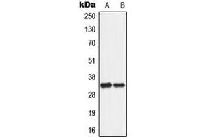 Image no. 1 for anti-Solute Carrier Family 25 (Mitochondrial Carrier, Adenine Nucleotide Translocator), Member 5 (SLC25A5) (Center) antibody (ABIN2705474)
