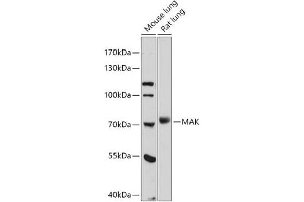 MAK anticorps  (AA 370-435)