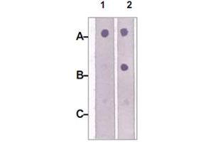 Image no. 2 for anti-Insulin Receptor Substrate 2 (IRS2) antibody (ABIN541009)