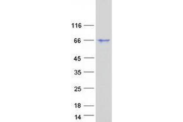 ZC3H15 Protein (Zinc Finger CCCH-Type Containing 15) (Myc-DYKDDDDK Tag)