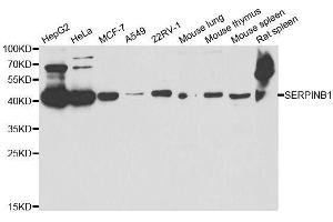 Image no. 1 for anti-serpin Peptidase Inhibitor, Clade B (Ovalbumin), Member 1 (SERPINB1) antibody (ABIN6147583)