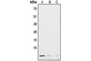 Image no. 1 for anti-Polymerase (RNA) III (DNA Directed) Polypeptide K, 12.3 KDa (POLR3K) (Center) antibody (ABIN2706852)