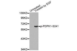Image no. 2 for anti-3-phosphoinositide Dependent Protein Kinase-1 (PDPK1) (pSer241) antibody (ABIN3020427)