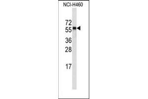 Image no. 1 for anti-Cytochrome P450, Family 4, Subfamily A, Polypeptide 11 (CYP4A11) (C-Term) antibody (ABIN360251)