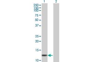 anti-Fracture Callus 1 Homolog (FXC1) (AA 1-103) antibody