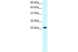 Image no. 2 for anti-MYST/Esa1-Associated Factor 6 (MEAF6) (N-Term) antibody (ABIN1108194)