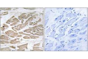 Image no. 2 for anti-Brain Protein 44-Like (BRP44L) (AA 11-60) antibody (ABIN1534701)