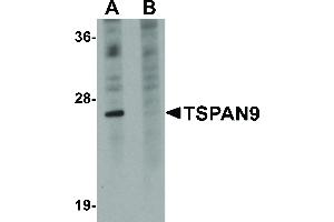 Image no. 1 for anti-Tetraspanin 9 (TSPAN9) (Internal Region) antibody (ABIN6656582)