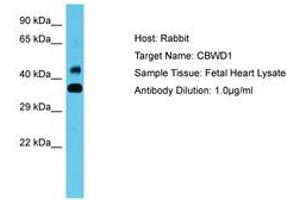 Image no. 1 for anti-COBW Domain Containing 1 (CBWD1) (AA 108-157) antibody (ABIN6750642)