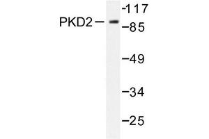 Image no. 1 for anti-Protein Kinase D2 (PKD2) antibody (ABIN272069)