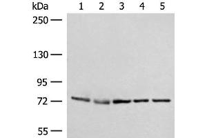 Western blot analysis of A172 231 Jurkat HepG2 and Hela cell lysates using POLH Polyclonal Antibody at dilution of 1:300