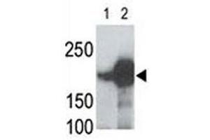 Image no. 2 for anti-Low Density Lipoprotein Receptor-Related Protein 5 (LRP5) (AA 1538-1567) antibody (ABIN3031641)