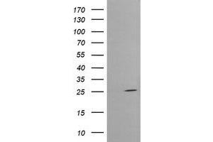Image no. 3 for anti-Cytidine Monophosphate (UMP-CMP) Kinase 1, Cytosolic (CMPK1) antibody (ABIN1497545)