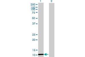 Image no. 1 for anti-Chemokine (C-X-C Motif) Ligand 11 (CXCL11) (AA 1-94) antibody (ABIN520077)