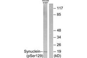 Western blot analysis of extracts from mouse brain, using Synuclein (Phospho-Ser129) Antibody.