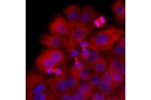 Image no. 2 for anti-Tubulin, beta 2B (TUBB2B) antibody (ABIN567629)