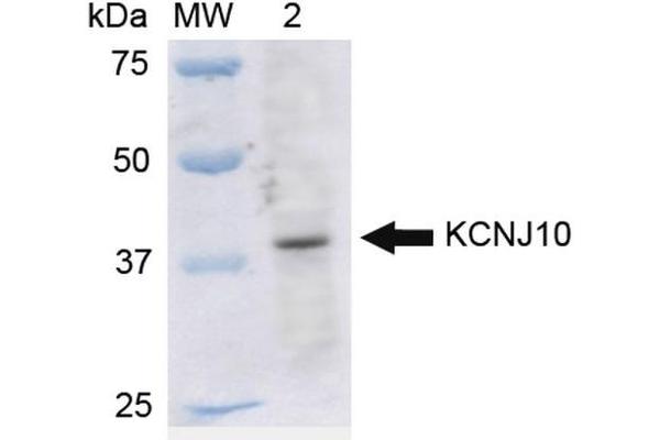 KCNJ10 Antikörper  (HRP)