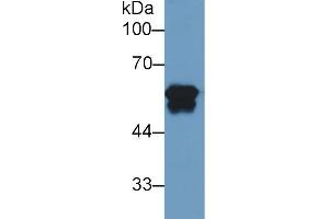 Image no. 2 for anti-Fibrinogen beta Chain (FGB) antibody (ABIN5983274)