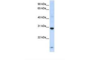 Image no. 1 for anti-Zinc Finger Protein 138 (ZNF138) (AA 177-226) antibody (ABIN6738382)
