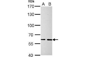 anti-Suppressor of Cytokine Signaling 5 (SOCS5) (N-Term) antibody