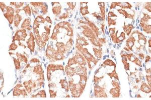 Immunohistochemistry of paraffin-embedded Human stomach using KIF4A Polyclonal Antibody at dilution of 1:100 (40x lens).