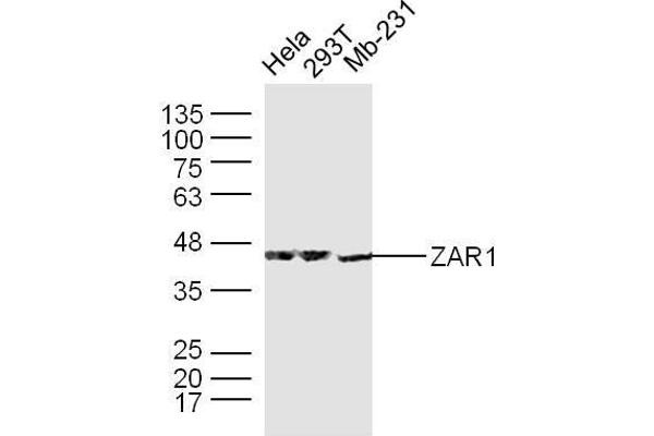 anti-Zygote Arrest 1 (ZAR1) (AA 351-424) antibody