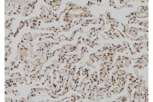 Image no. 2 for anti-Zinc Finger, CCHC Domain Containing 11 (ZCCHC11) antibody (ABIN6266092)