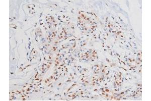 Image no. 2 for anti-Mast/stem Cell Growth Factor Receptor (KIT) (pTyr703) antibody (ABIN6255994)
