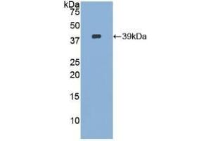 Ezrin Antikörper  (AA 1-295)