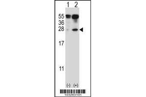 Image no. 1 for anti-Interleukin 27 (IL27) (Center) antibody (ABIN2489302)