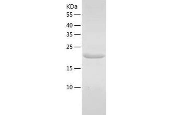 KDELC1 Protein (AA 326-494) (His tag)