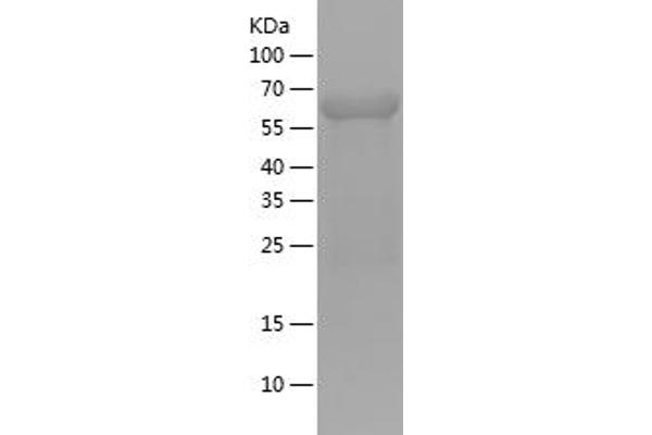IKBKG Protein (AA 120-419) (His-IF2DI Tag)