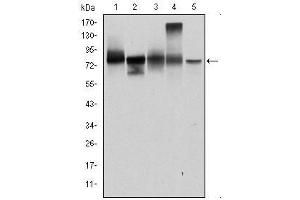 Image no. 4 for anti-Junction Plakoglobin (JUP) antibody (ABIN1107899)
