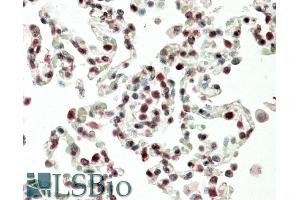 Image no. 2 for anti-Homeobox B6 (HOXB6) (Internal Region) antibody (ABIN1781955)