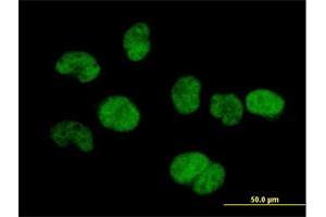 Image no. 4 for anti-tRNA Splicing Endonuclease 34 Homolog (TSEN34) (AA 1-390) antibody (ABIN528876)