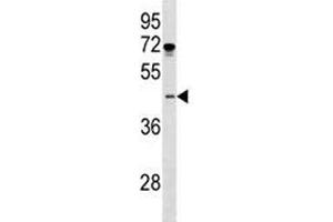 Image no. 3 for anti-ISL LIM Homeobox 1 (ISL1) (AA 156-185) antibody (ABIN3031505)