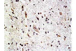Image no. 1 for anti-Neurofascin (NFASC) (AA 501-650) antibody (ABIN727325)