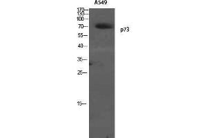 Image no. 1 for anti-Tumor Protein P73 (TP73) (Tyr220) antibody (ABIN3186304)